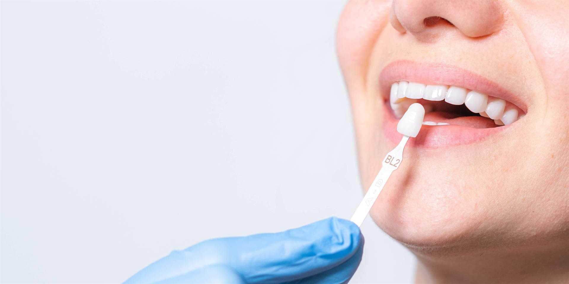 Estética dental en Oleiros